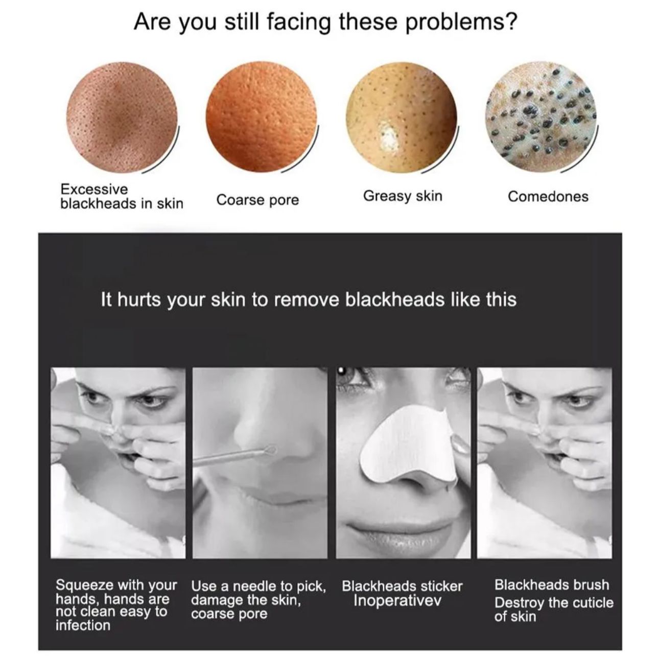 5 in 1 Electric Blackhead Acne Oil Remover Vacuum Suction Face Pore Cleaner Machine