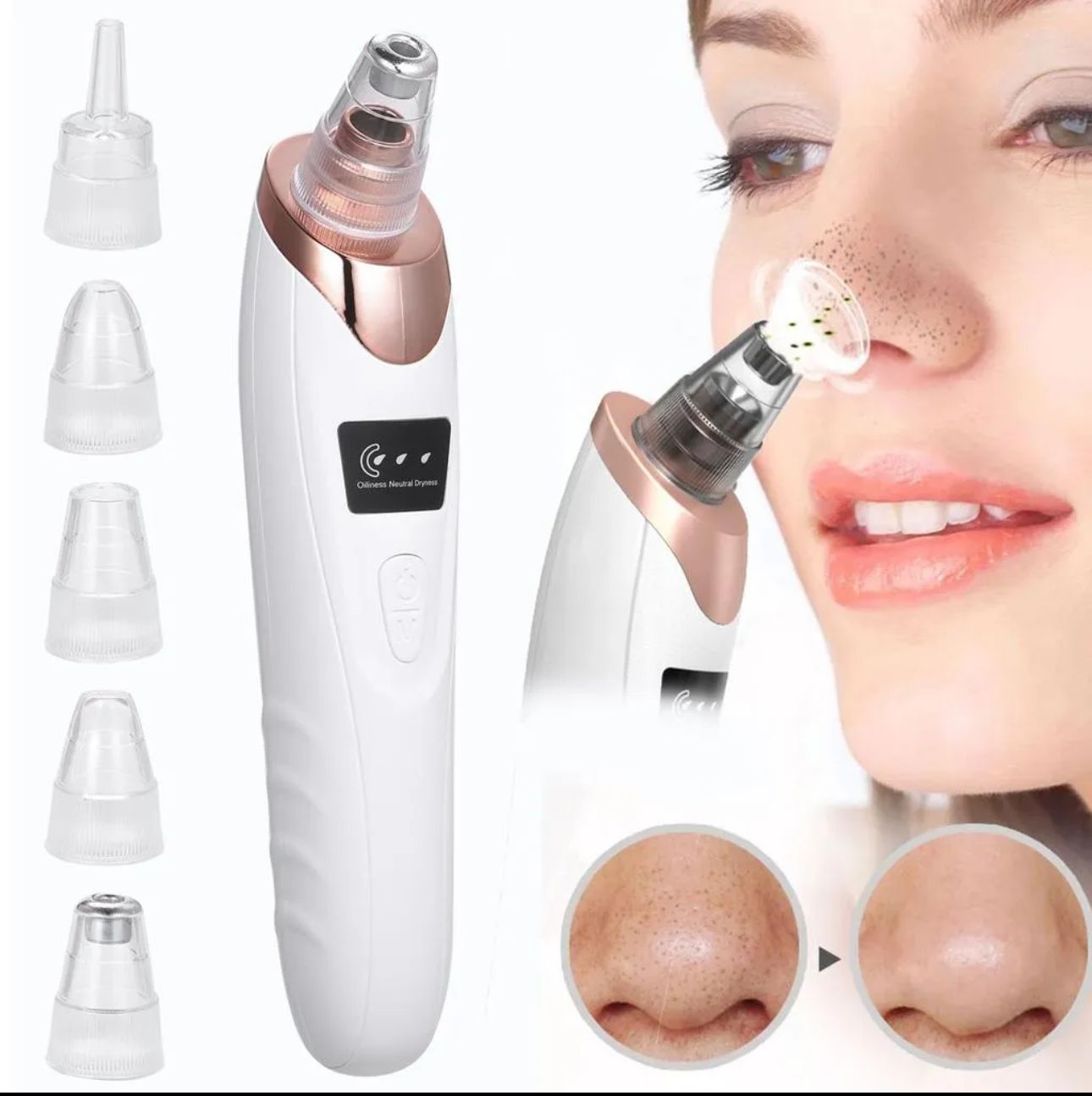5 in 1 Electric Blackhead Acne Oil Remover Vacuum Suction Face Pore Cleaner Machine
